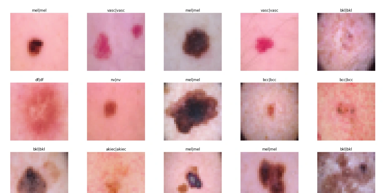Test/evaluate skin cancer augmented data
