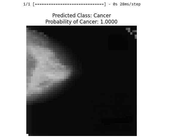 Test 2 Breast Cancer Detection