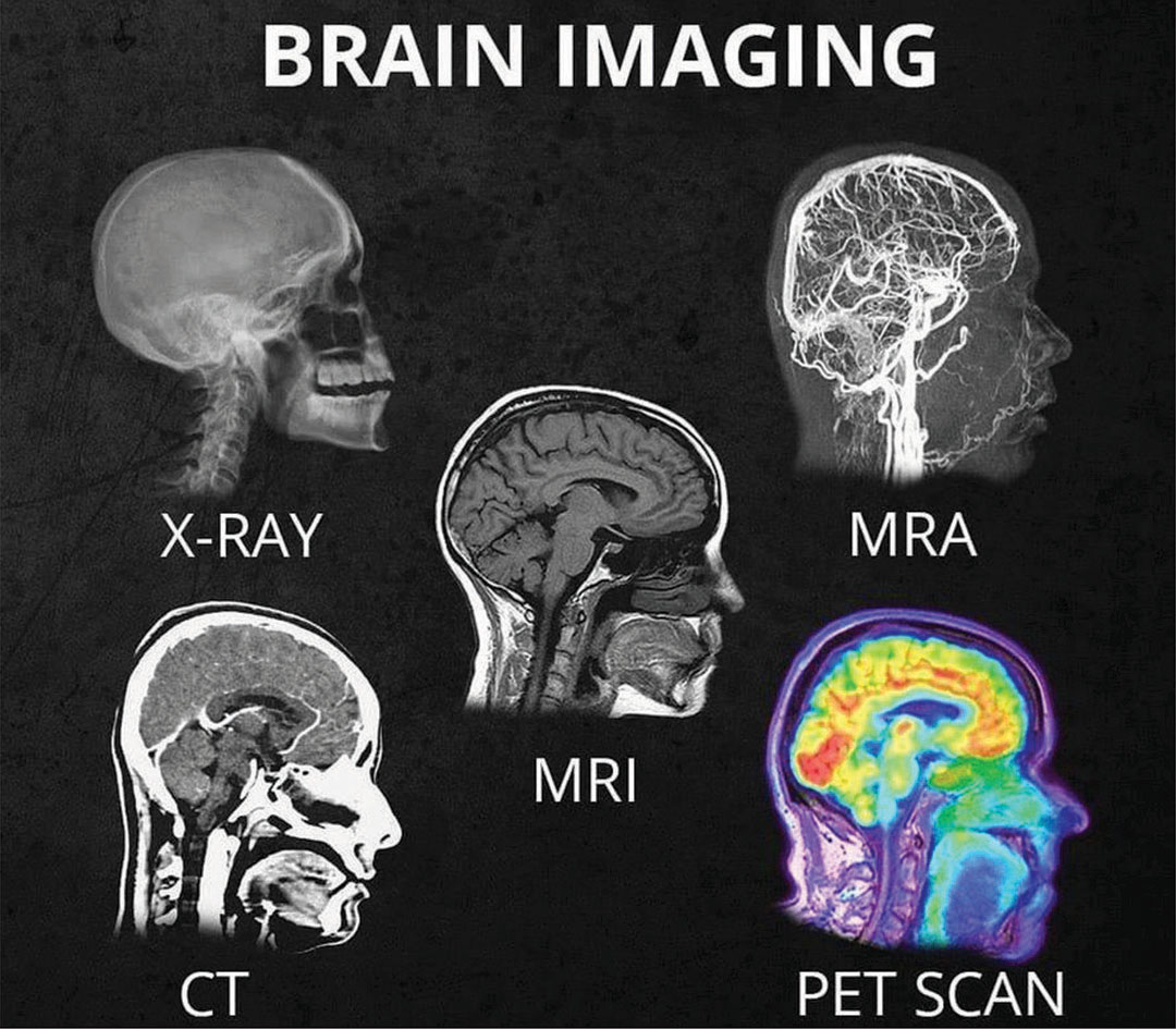 MRI, CT, and X-ray scan analysis